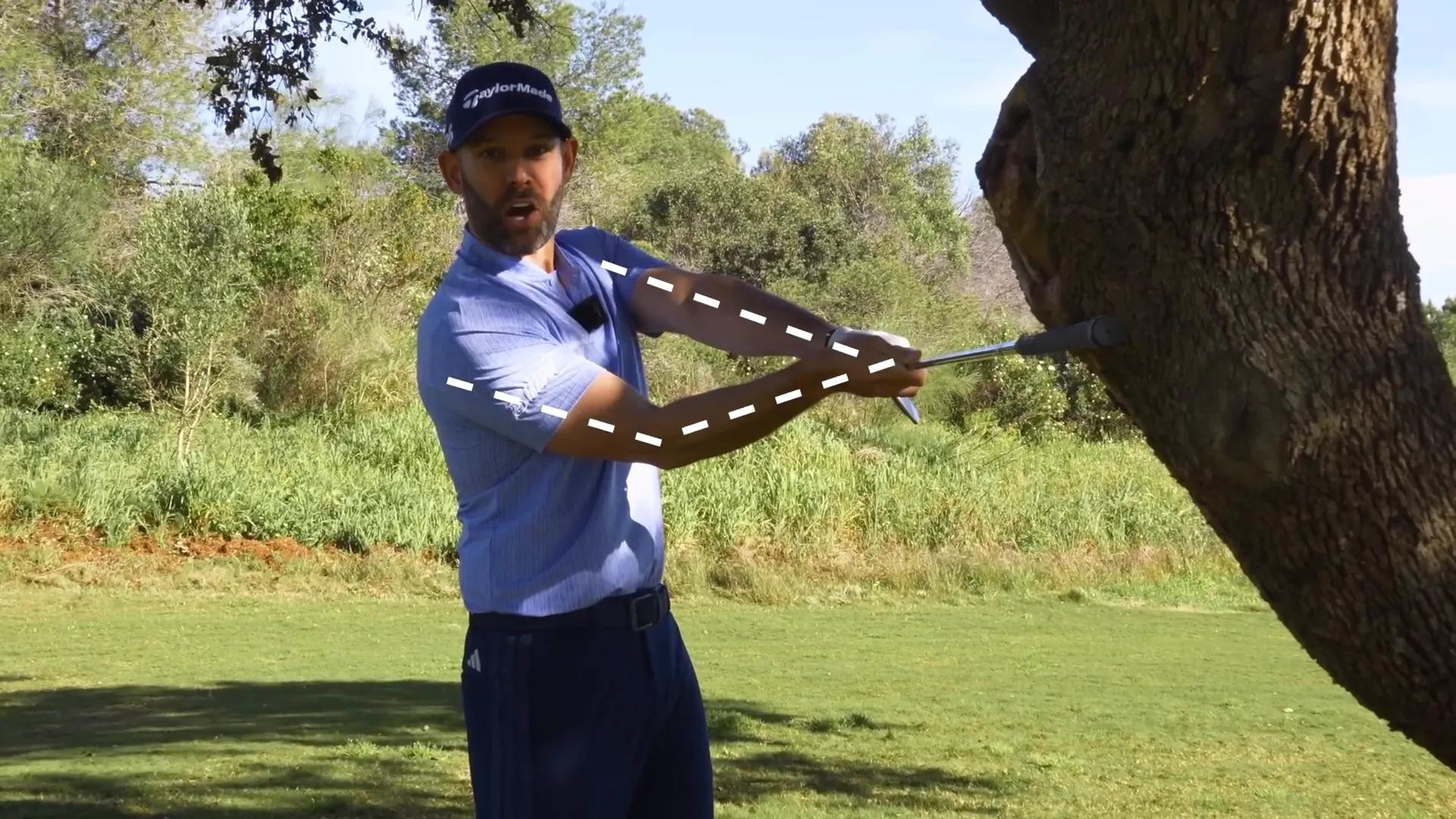 Demonstrating arm structure with tree